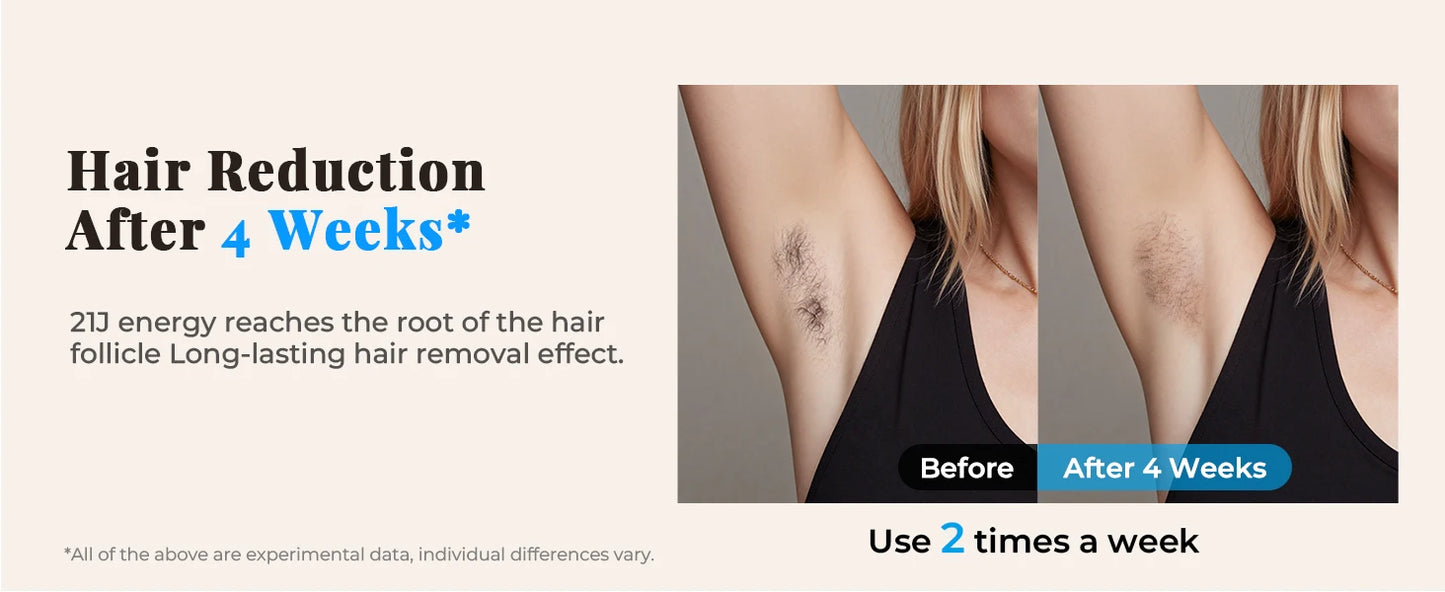 Epilatore Laser IPL Professionale 999.900 Flash 21J - Depilazione Permanente Viso Corpo Bikini