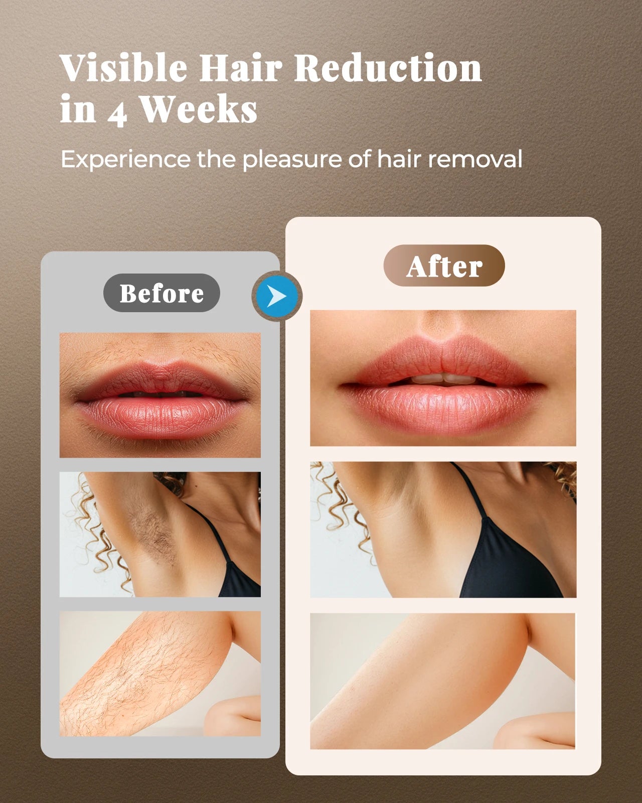 Epilatore Laser IPL Professionale 999.900 Flash 21J - Depilazione Permanente Viso Corpo Bikini