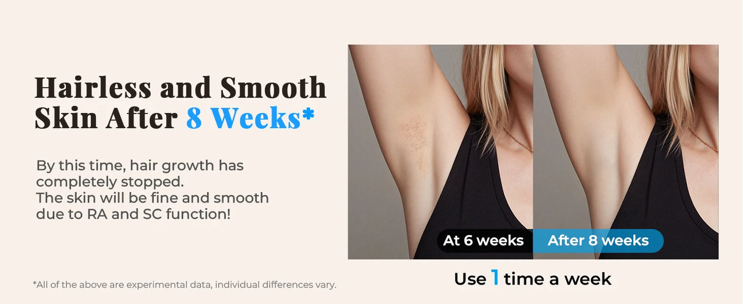 Epilatore Laser IPL Professionale 999.900 Flash 21J - Depilazione Permanente Viso Corpo Bikini